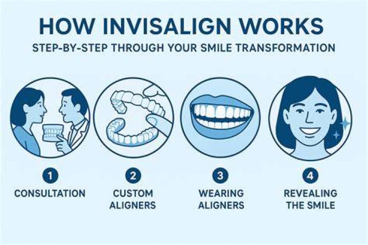 How does Invisalign move teeth down?