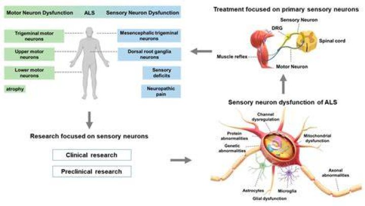 What disease affects sensory neurons?